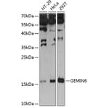Western Blot - Anti-Gemin6/SIP2 Antibody (A88465) - Antibodies.com