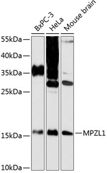 Western blot analysis of extracts of various cell lines, using Anti-MPZL1 Antibody (A13059) at 1:3000 dilution.
Secondary antibody: Goat Anti-Rabbit IgG (H+L) (HRP) (AS014) at 1:10,000 dilution.
Lysates / proteins: 25µg per lane.
Blocking buffer: 3% non-fat dry milk in TBST.
Detection: ECL Enhanced Kit (RM00021).
Exposure time: 90s.