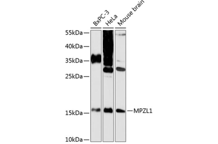 Western Blot - Anti-MPZL Antibody (A88466) - Antibodies.com