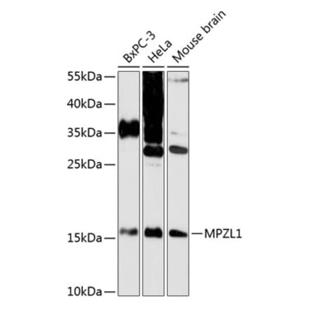 Western Blot - Anti-MPZL Antibody (A88466) - Antibodies.com