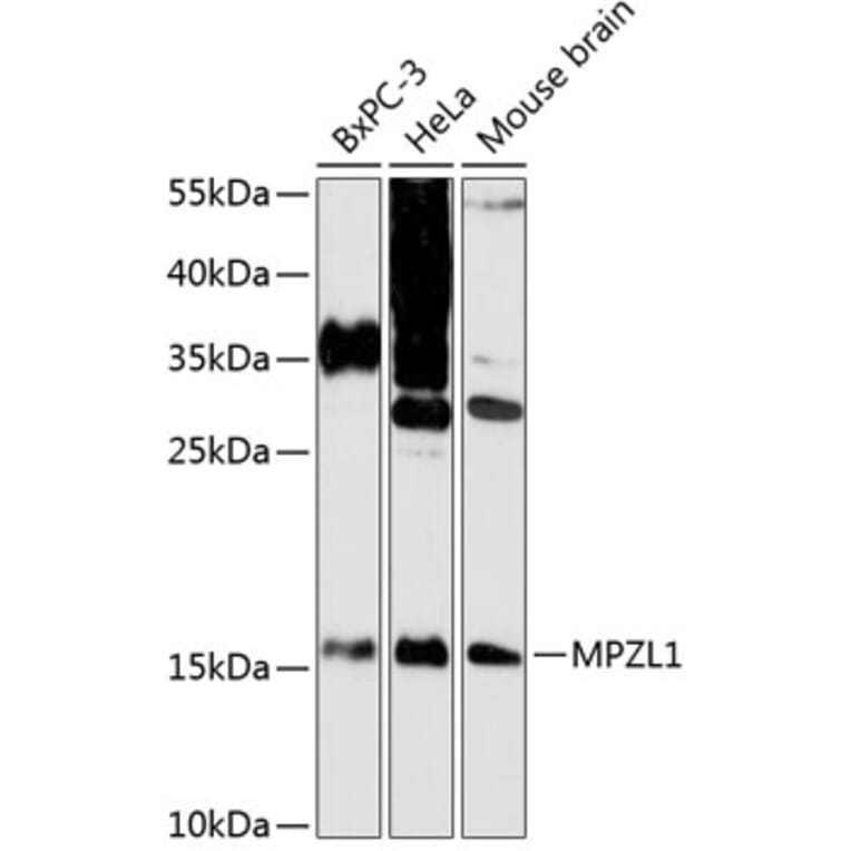 Western Blot - Anti-MPZL Antibody (A88466) - Antibodies.com