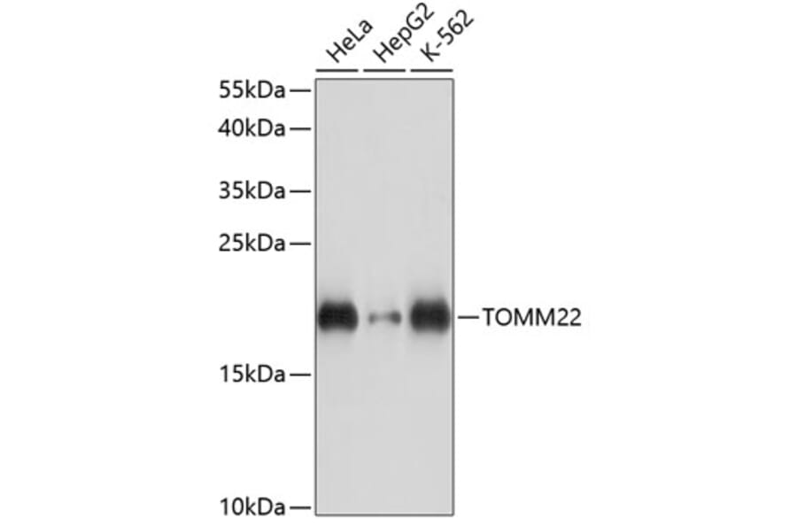 Western Blot - Anti-TOMM22/TOM22 Antibody (A88467) - Antibodies.com