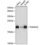 Western Blot - Anti-TOMM22/TOM22 Antibody (A88467) - Antibodies.com