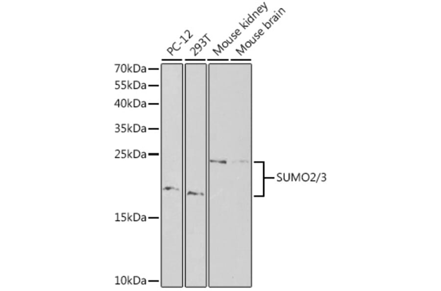Western Blot - Anti-Sumo 2 Antibody (A88468) - Antibodies.com