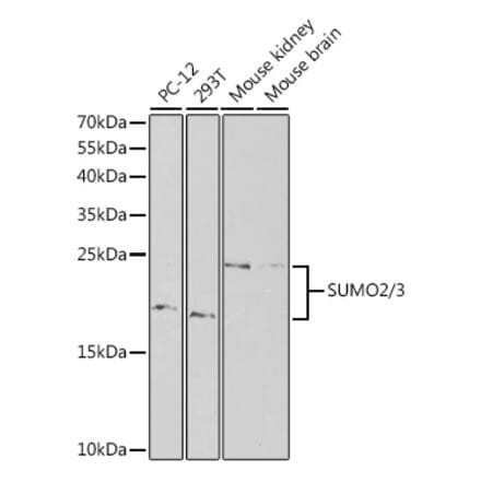Western Blot - Anti-Sumo 2 Antibody (A88468) - Antibodies.com