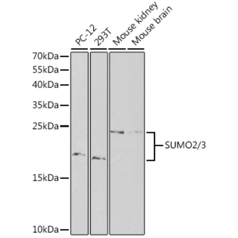 Western Blot - Anti-Sumo 2 Antibody (A88468) - Antibodies.com