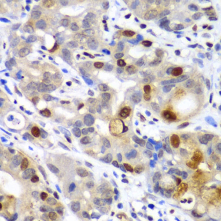 Immunohistochemistry - Anti-Sumo 2 Antibody (A88468) - Antibodies.com