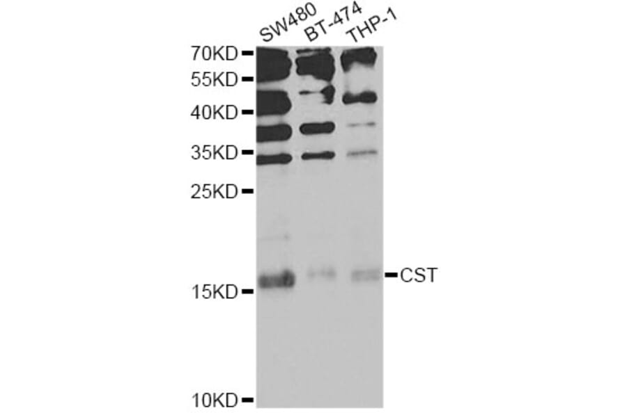 Western Blot - Anti-CST1 Antibody (A13290) - Antibodies.com