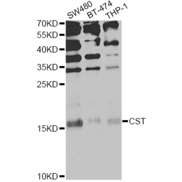 Western Blot - Anti-CST1 Antibody (A13290) - Antibodies.com