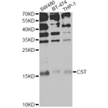 Western Blot - Anti-CST1 Antibody (A13290) - Antibodies.com