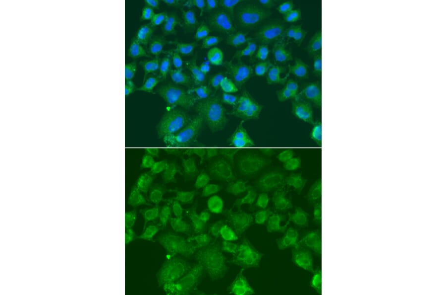 Immunofluorescence - Anti-CST1 Antibody (A13290) - Antibodies.com
