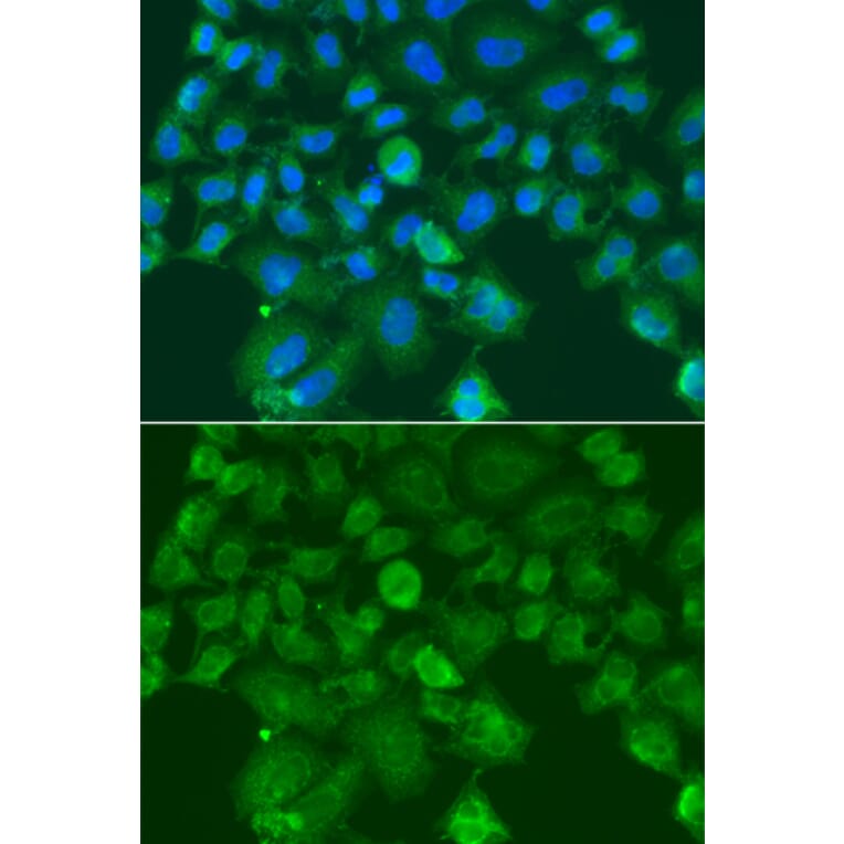 Immunofluorescence - Anti-CST1 Antibody (A13290) - Antibodies.com