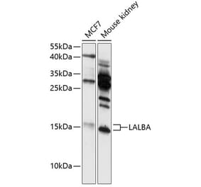 Western Blot - Anti-alpha Lactalbumin Antibody (A88470) - Antibodies.com