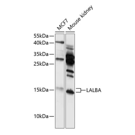 Western Blot - Anti-alpha Lactalbumin Antibody (A88470) - Antibodies.com