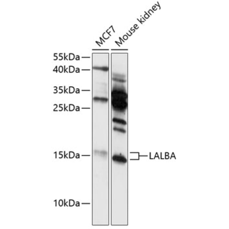 Western Blot - Anti-alpha Lactalbumin Antibody (A88470) - Antibodies.com