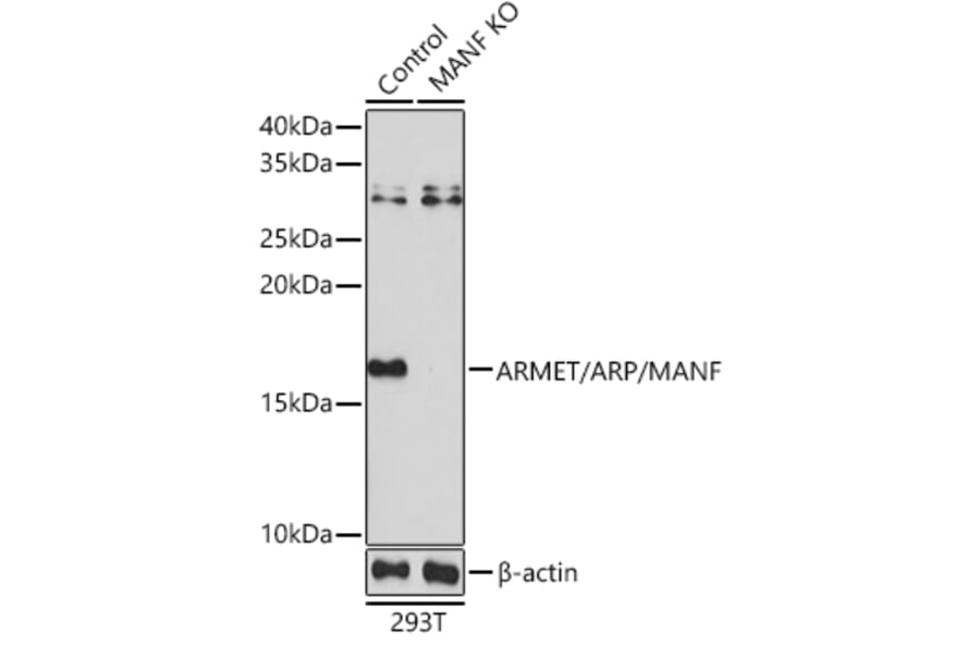 Western Blot - Anti-ARMET / ARP Antibody (A88471) - Antibodies.com
