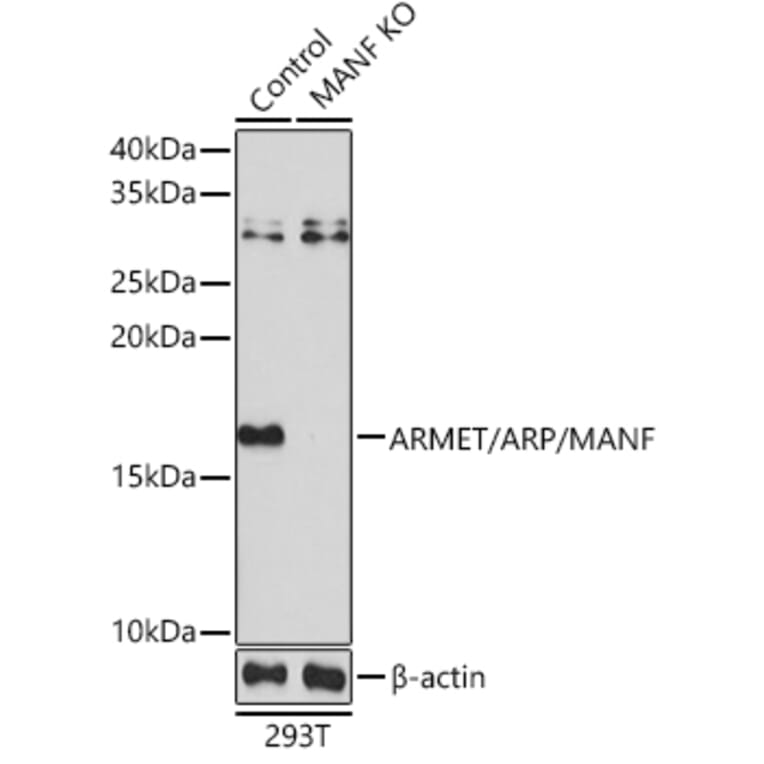 Western Blot - Anti-ARMET / ARP Antibody (A88471) - Antibodies.com
