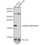 Western Blot - Anti-ARMET / ARP Antibody (A88471) - Antibodies.com