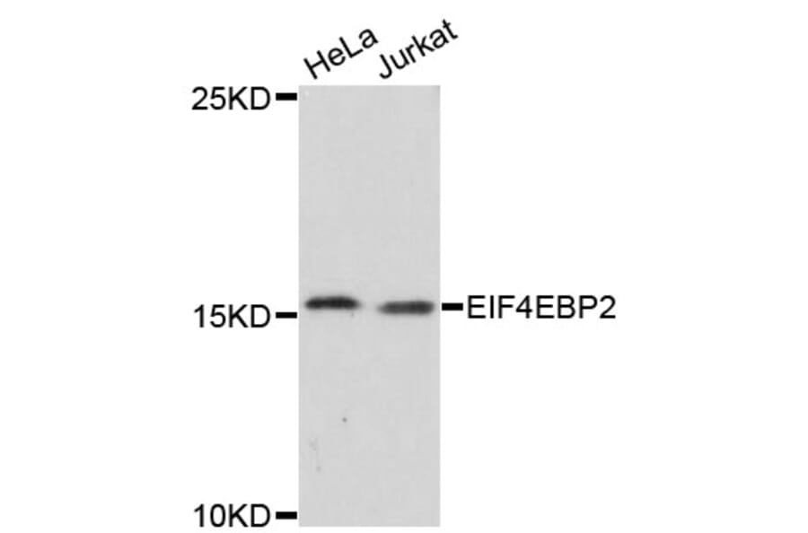 Western Blot - Anti-EIF4EBP2 Antibody (A13691) - Antibodies.com