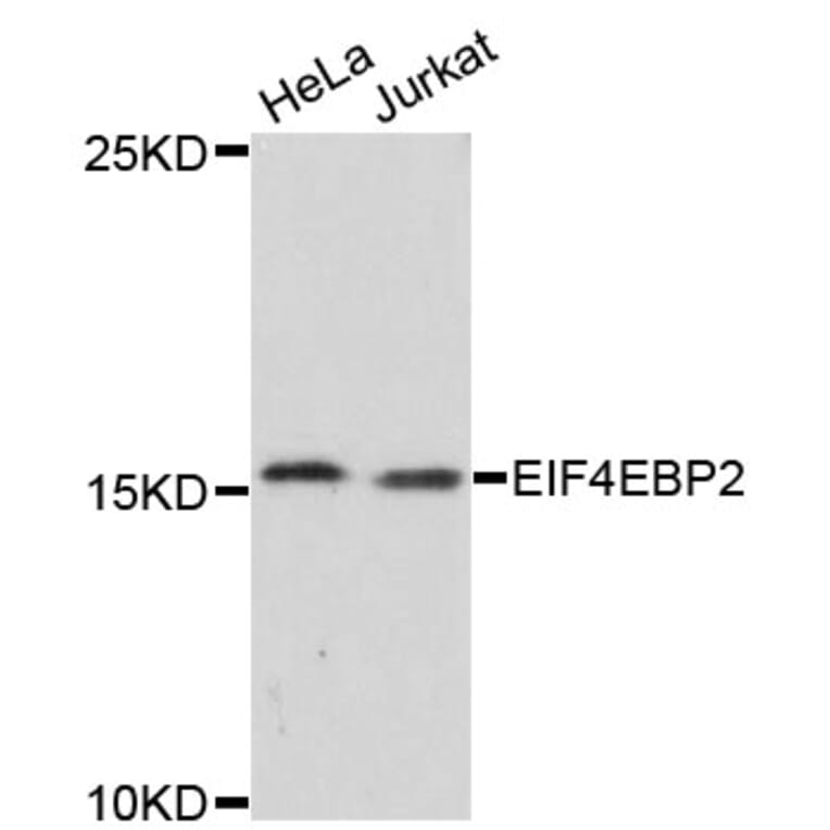 Western Blot - Anti-EIF4EBP2 Antibody (A13691) - Antibodies.com