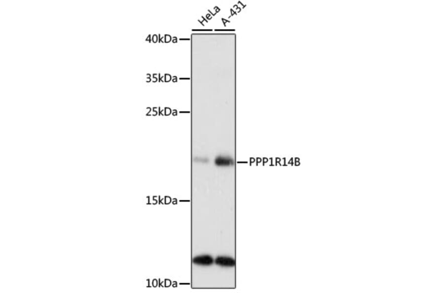 Western Blot - Anti-PPP1R14B/PNG Antibody (A88473) - Antibodies.com
