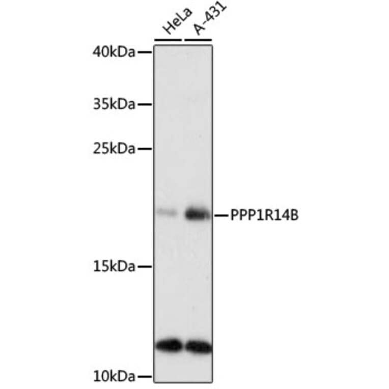Western Blot - Anti-PPP1R14B/PNG Antibody (A88473) - Antibodies.com