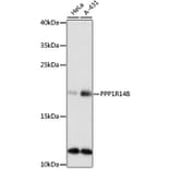 Western Blot - Anti-PPP1R14B/PNG Antibody (A88473) - Antibodies.com