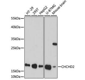 Western Blot - Anti-CHCHD2 Antibody (A88474) - Antibodies.com