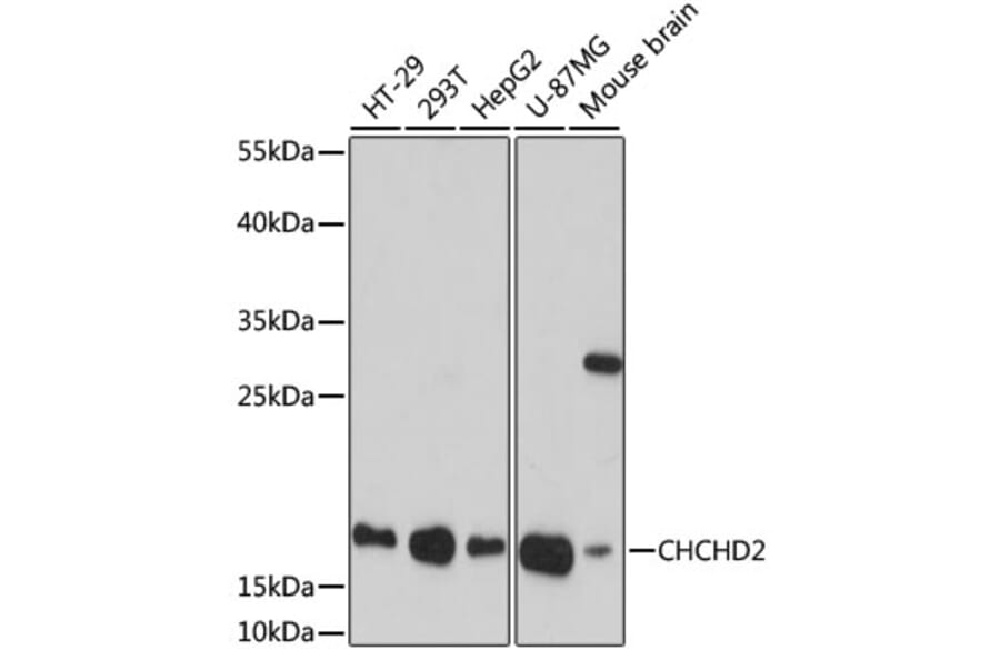 Western Blot - Anti-CHCHD2 Antibody (A88474) - Antibodies.com
