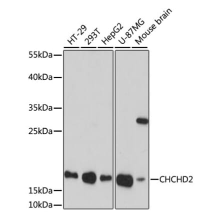 Western Blot - Anti-CHCHD2 Antibody (A88474) - Antibodies.com