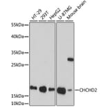 Western Blot - Anti-CHCHD2 Antibody (A88474) - Antibodies.com