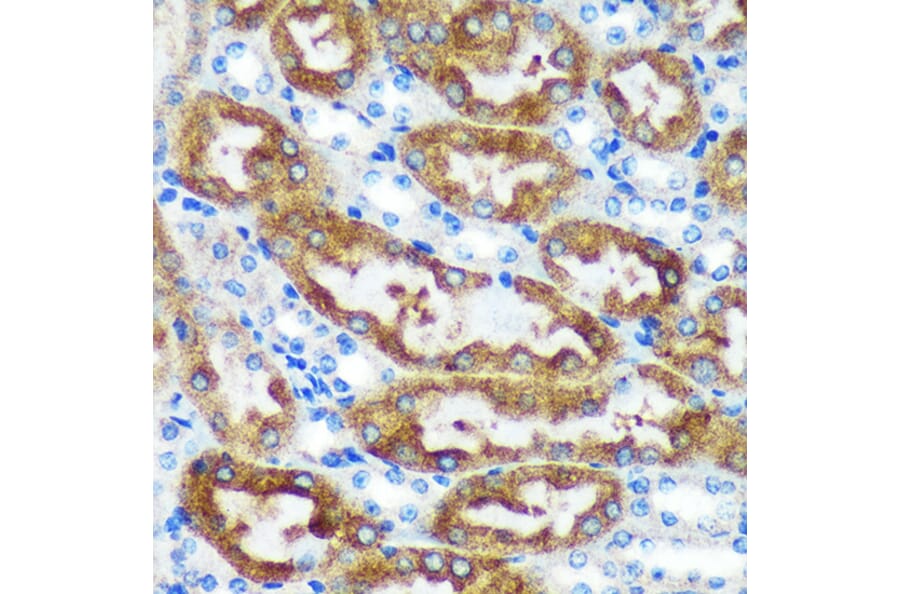 Immunohistochemistry - Anti-CHCHD2 Antibody (A88474) - Antibodies.com