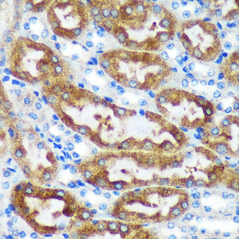 Immunohistochemistry - Anti-CHCHD2 Antibody (A88474) - Antibodies.com