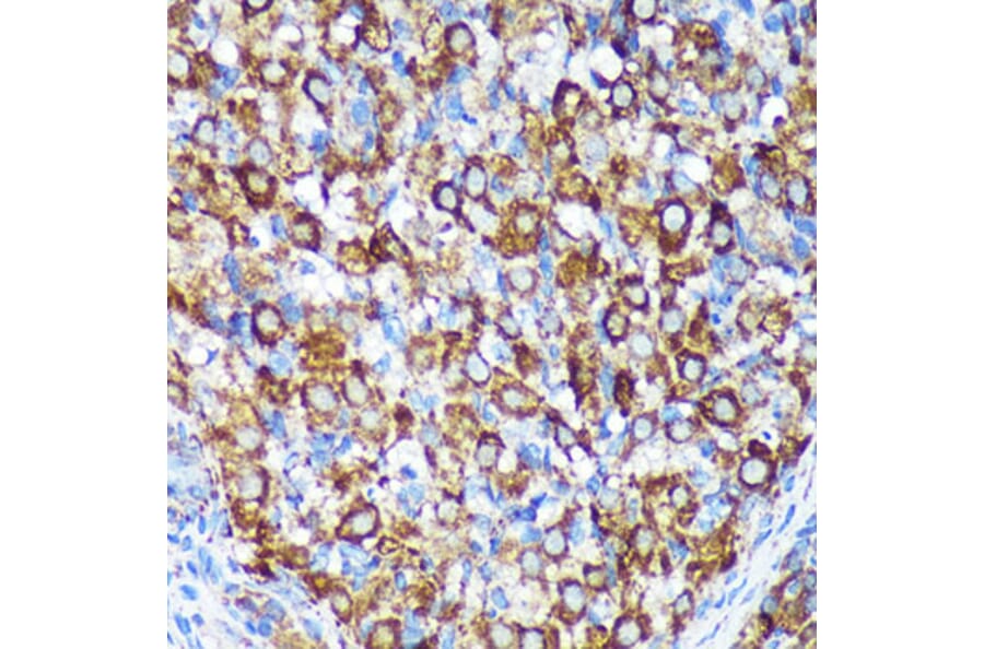 Immunohistochemistry - Anti-CHCHD2 Antibody (A88474) - Antibodies.com