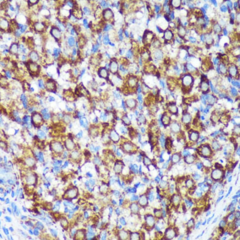 Immunohistochemistry - Anti-CHCHD2 Antibody (A88474) - Antibodies.com