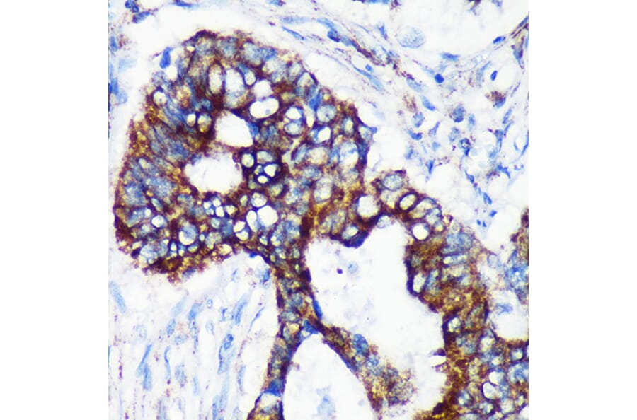 Immunohistochemistry - Anti-CHCHD2 Antibody (A88474) - Antibodies.com