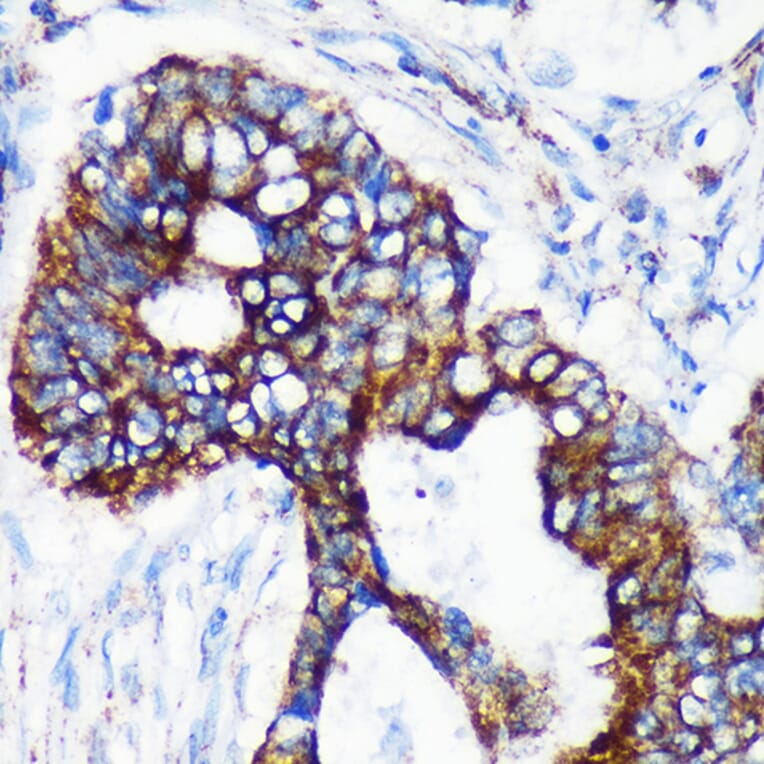 Immunohistochemistry - Anti-CHCHD2 Antibody (A88474) - Antibodies.com