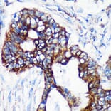 Immunohistochemistry - Anti-CHCHD2 Antibody (A88474) - Antibodies.com