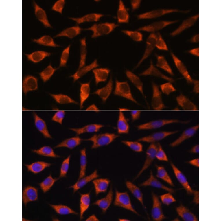 Immunofluorescence - Anti-CHCHD2 Antibody (A88474) - Antibodies.com