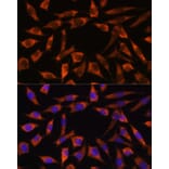 Immunofluorescence - Anti-CHCHD2 Antibody (A88474) - Antibodies.com