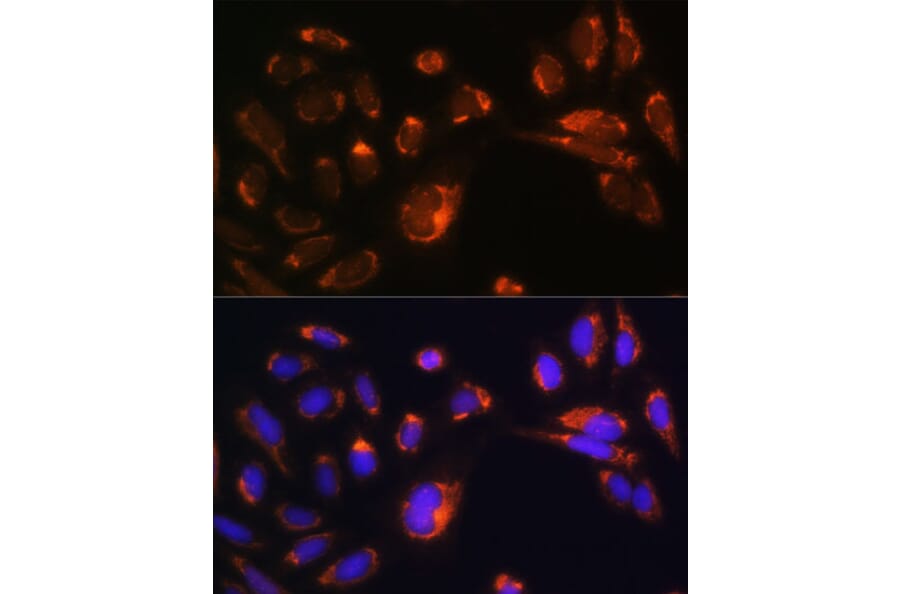 Immunofluorescence - Anti-CHCHD2 Antibody (A88474) - Antibodies.com