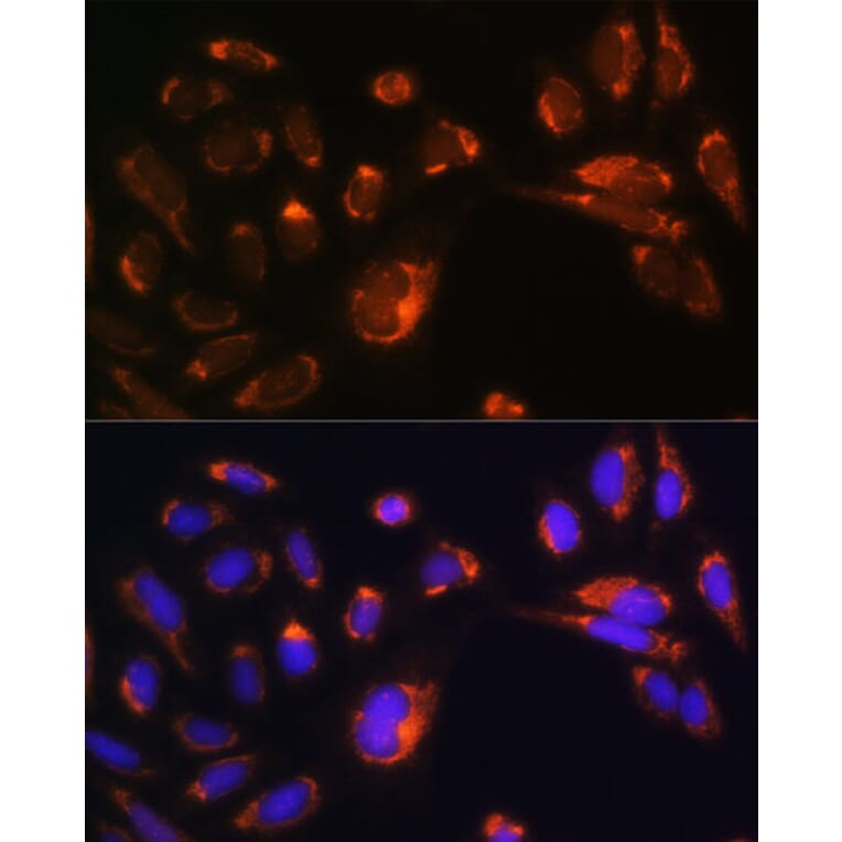 Immunofluorescence - Anti-CHCHD2 Antibody (A88474) - Antibodies.com