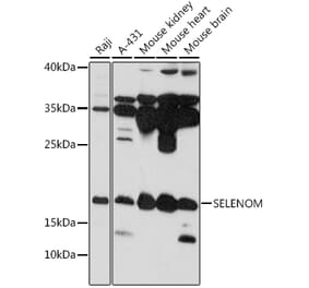 Western Blot - Anti-SelM Antibody (A88475) - Antibodies.com