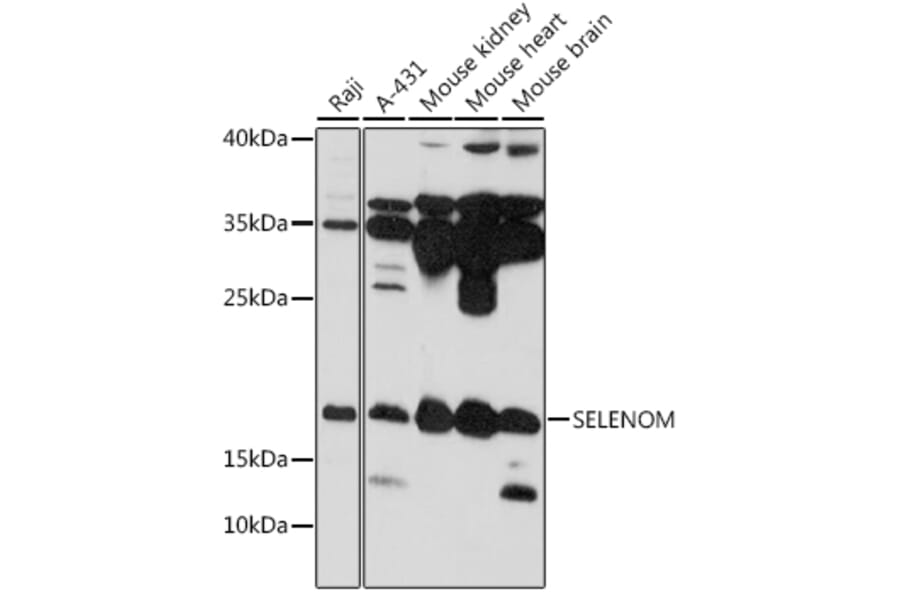 Western Blot - Anti-SelM Antibody (A88475) - Antibodies.com