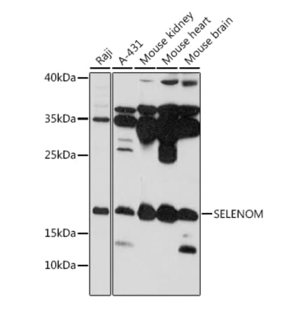 Western Blot - Anti-SelM Antibody (A88475) - Antibodies.com