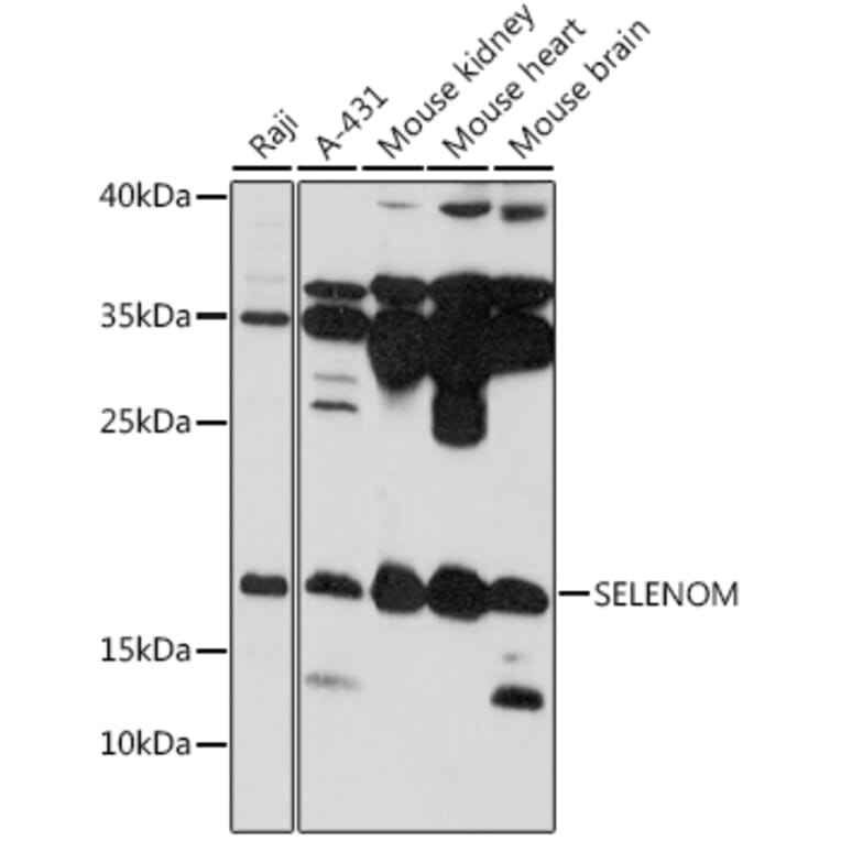Western Blot - Anti-SelM Antibody (A88475) - Antibodies.com