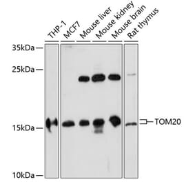 Western Blot - Anti-TOMM20 Antibody (A88476) - Antibodies.com