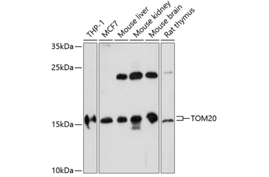 Western Blot - Anti-TOMM20 Antibody (A88476) - Antibodies.com