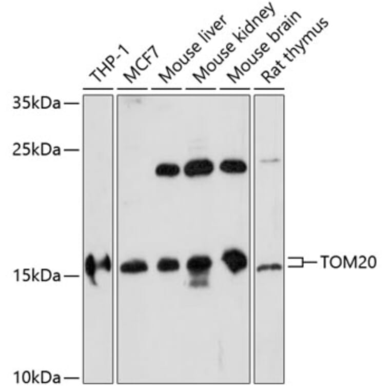 Western Blot - Anti-TOMM20 Antibody (A88476) - Antibodies.com