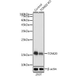 Western Blot - Anti-TOMM20 Antibody (A88476) - Antibodies.com